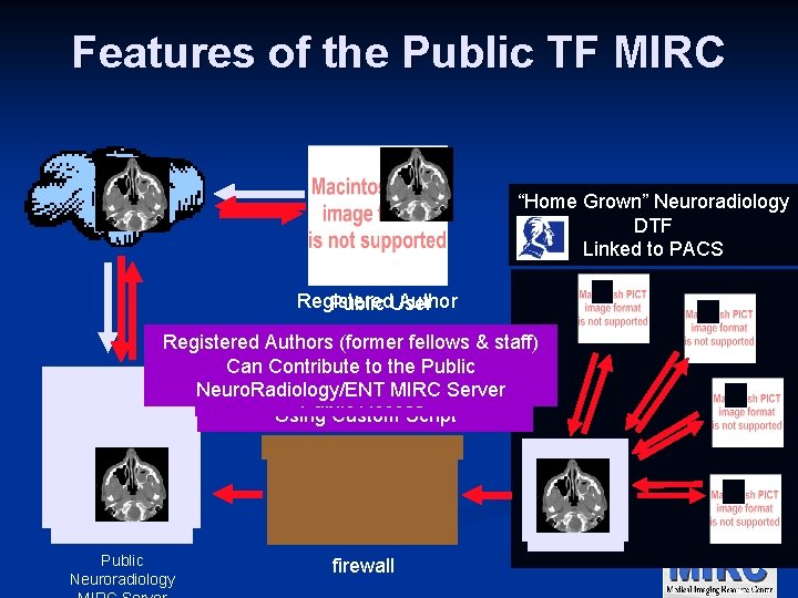 Features of the Public TF MIRC Internet “Home Grown” Neuroradiology DTF Linked to PACS