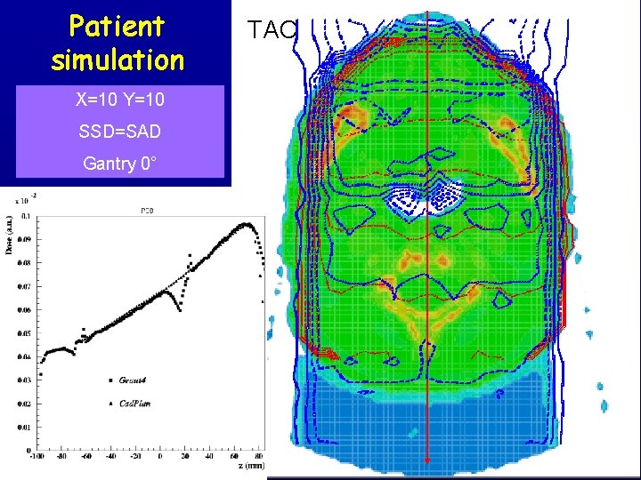 Patient simulation X=10 Y=10 SSD=SAD Gantry 0° TAC 