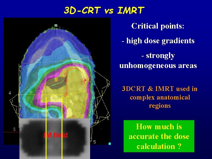 3 D-CRT vs IMRT Critical points: - high dose gradients - strongly unhomogeneous areas