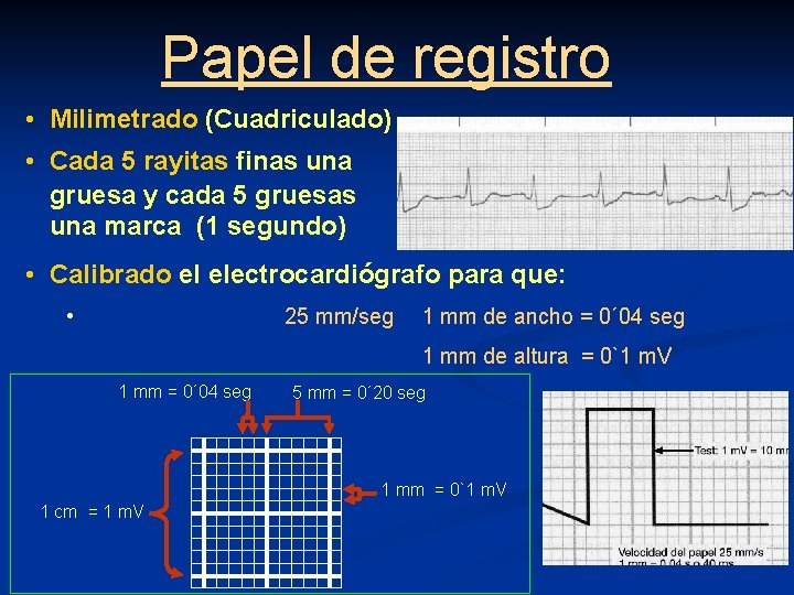 Papel de registro • Milimetrado (Cuadriculado) • Cada 5 rayitas finas una gruesa y