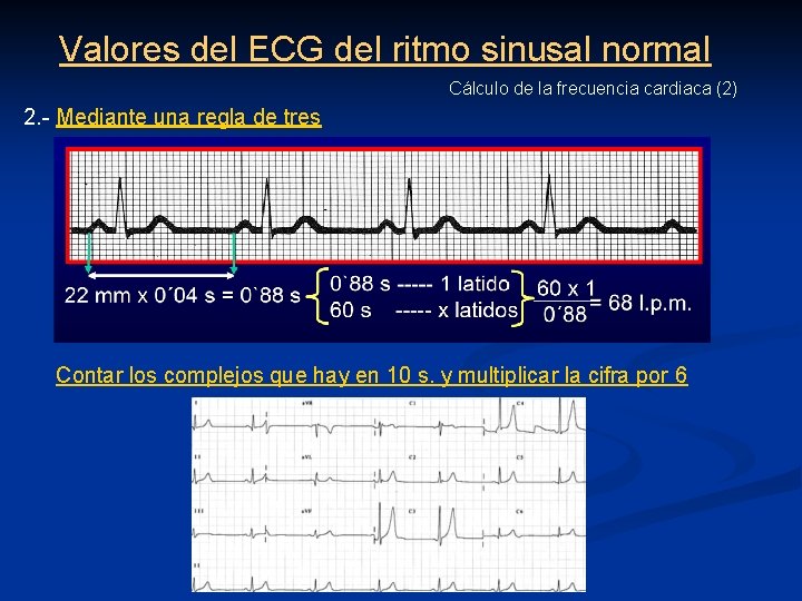 Valores del ECG del ritmo sinusal normal Cálculo de la frecuencia cardiaca (2) 2.