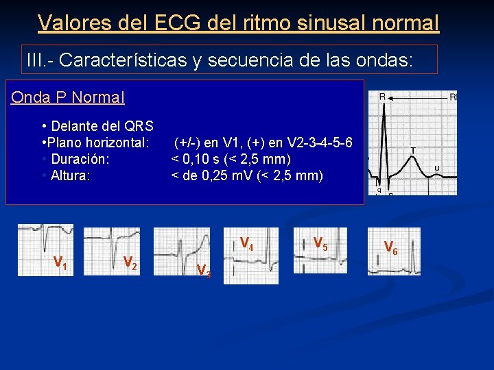 Valores del ECG del ritmo sinusal normal III. - Características y secuencia de las