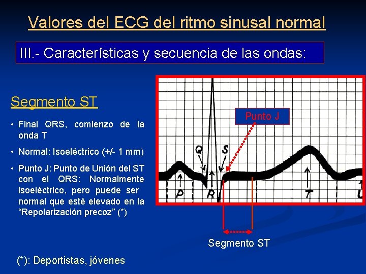 Valores del ECG del ritmo sinusal normal III. - Características y secuencia de las