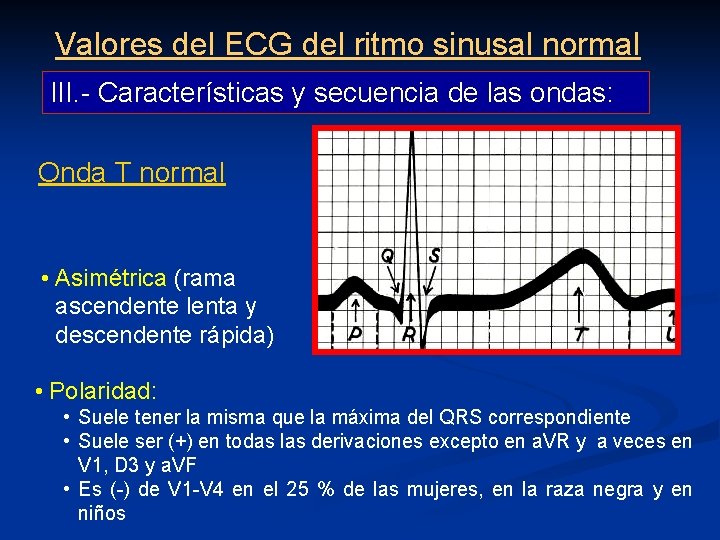 Valores del ECG del ritmo sinusal normal III. - Características y secuencia de las