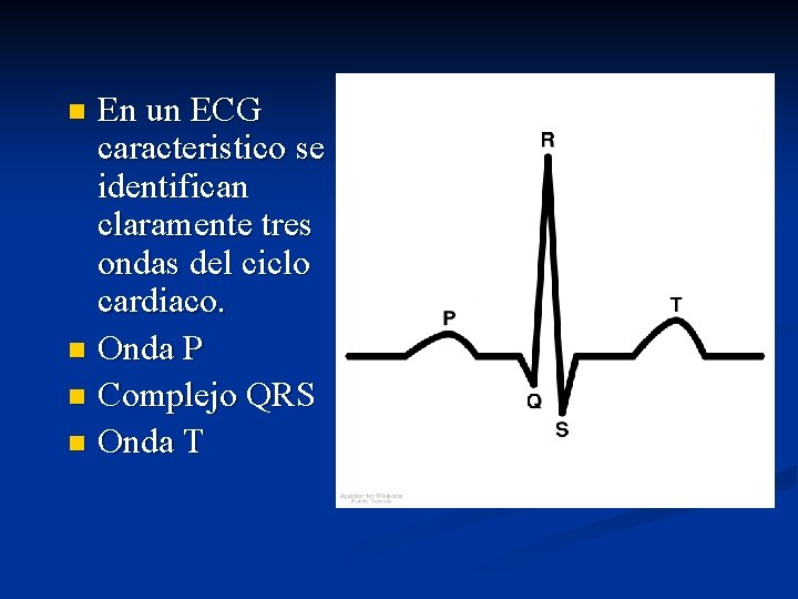 En un ECG caracteristico se identifican claramente tres ondas del ciclo cardiaco. n Onda
