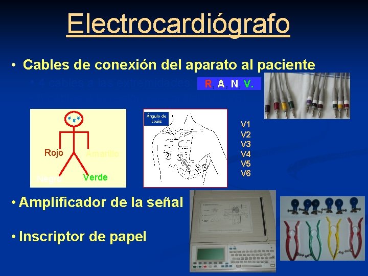 Electrocardiógrafo • Cables de conexión del aparato al paciente • 4 cables a las