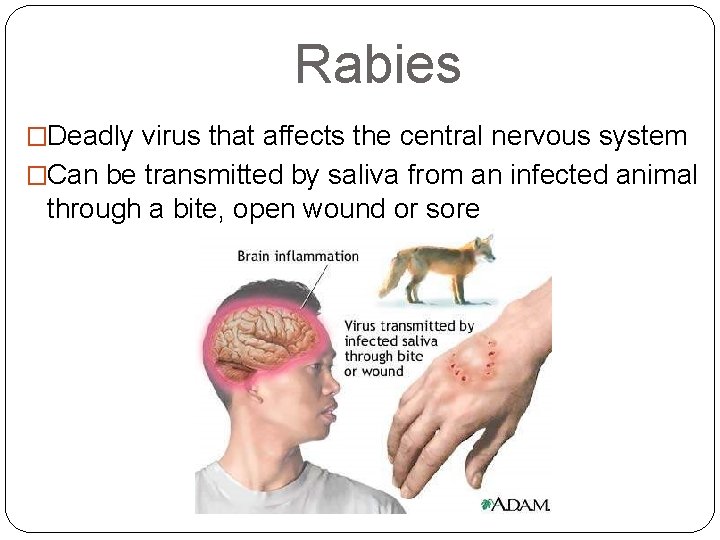 Rabies �Deadly virus that affects the central nervous system �Can be transmitted by saliva