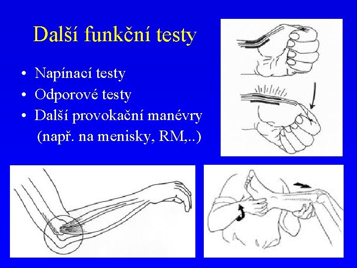 Další funkční testy • Napínací testy • Odporové testy • Další provokační manévry (např.