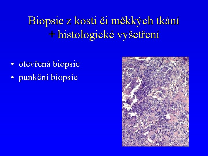 Biopsie z kosti či měkkých tkání + histologické vyšetření • otevřená biopsie • punkční