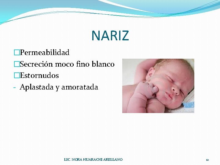 NARIZ �Permeabilidad �Secreción moco fino blanco �Estornudos - Aplastada y amoratada LIC. NORA HUARACHI