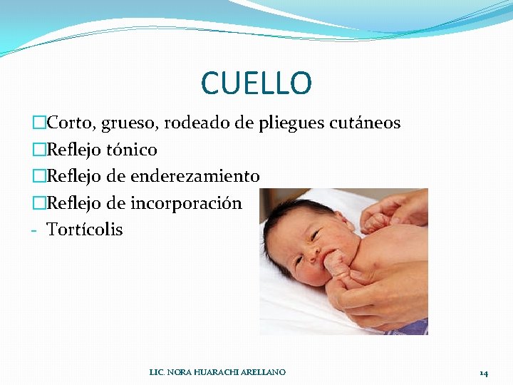 CUELLO �Corto, grueso, rodeado de pliegues cutáneos �Reflejo tónico �Reflejo de enderezamiento �Reflejo de