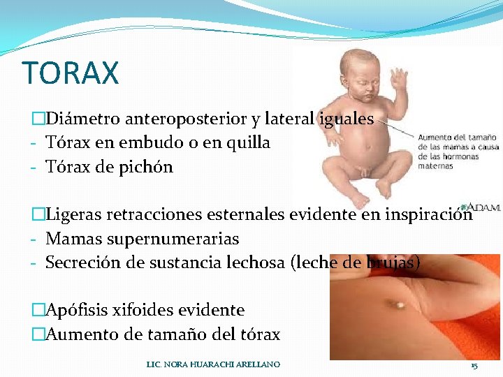 TORAX �Diámetro anteroposterior y lateral iguales - Tórax en embudo o en quilla -