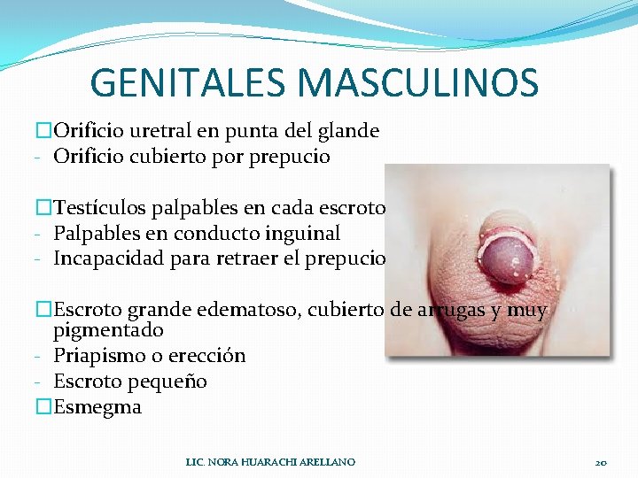 GENITALES MASCULINOS �Orificio uretral en punta del glande - Orificio cubierto por prepucio �Testículos