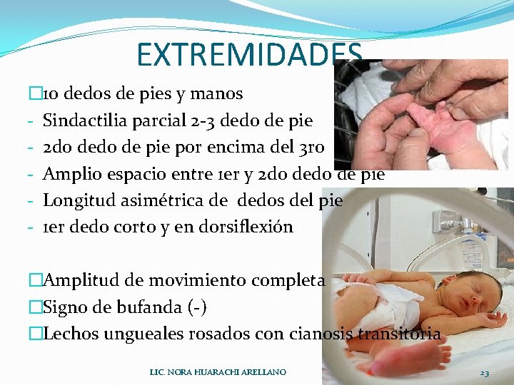 EXTREMIDADES � 10 dedos de pies y manos - Sindactilia parcial 2 -3 dedo