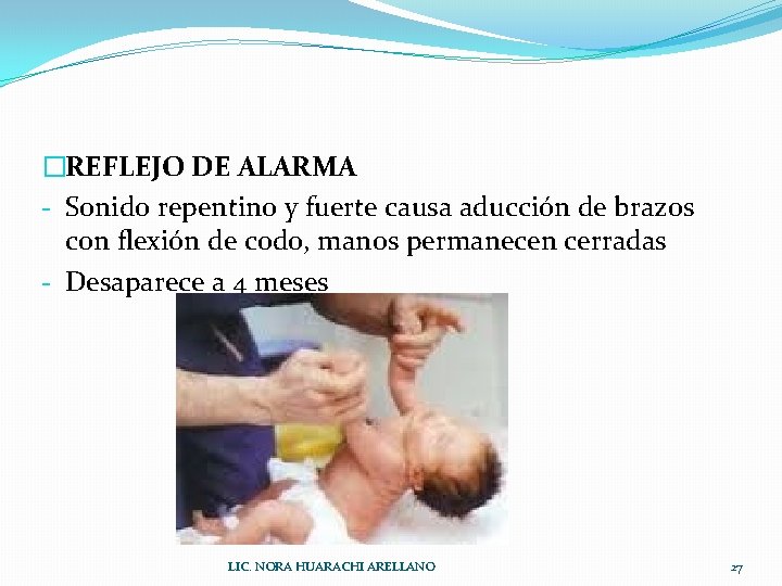 �REFLEJO DE ALARMA - Sonido repentino y fuerte causa aducción de brazos con flexión