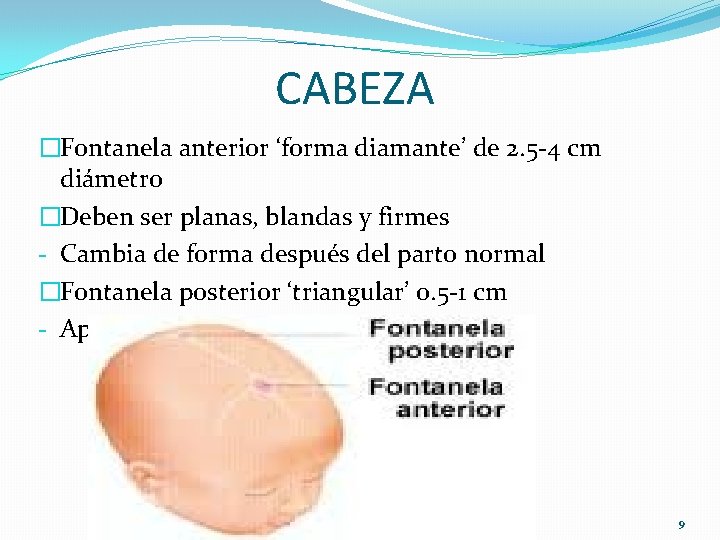 CABEZA �Fontanela anterior ‘forma diamante’ de 2. 5 -4 cm diámetro �Deben ser planas,