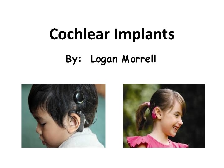 Cochlear Implants By: Logan Morrell 