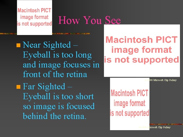 How You See Near Sighted – Eyeball is too long and image focuses in