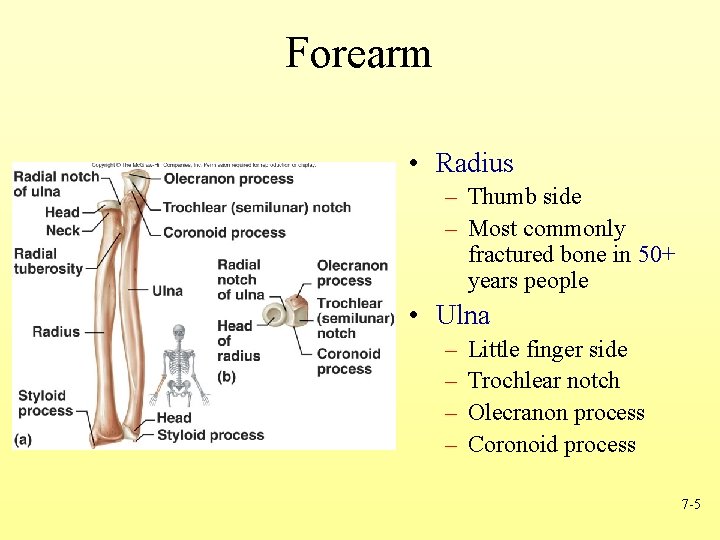 Forearm • Radius – Thumb side – Most commonly fractured bone in 50+ years