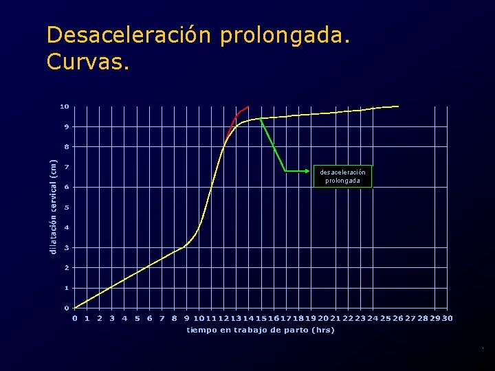 Desaceleración prolongada. Curvas. desaceleración prolongada . 