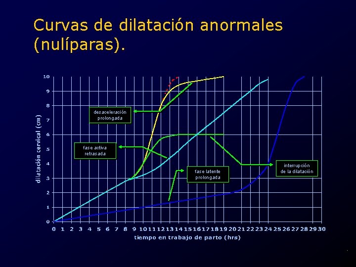 Curvas de dilatación anormales (nulíparas). desaceleración prolongada fase activa retrasada fase latente prolongada interrupción