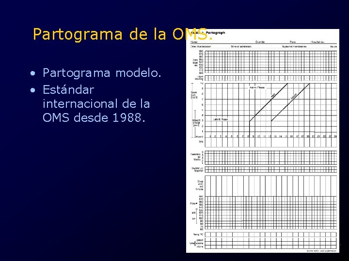 Partograma de la OMS. • Partograma modelo. • Estándar internacional de la OMS desde