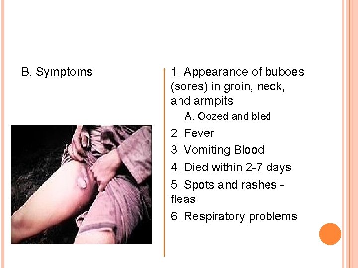 B. Symptoms 1. Appearance of buboes (sores) in groin, neck, and armpits A. Oozed