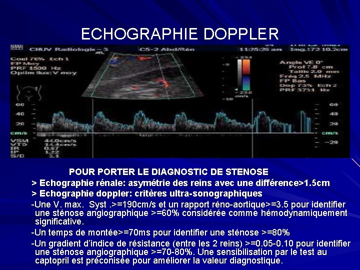 ECHOGRAPHIE DOPPLER POUR PORTER LE DIAGNOSTIC DE STENOSE > Echographie rénale: asymétrie des reins