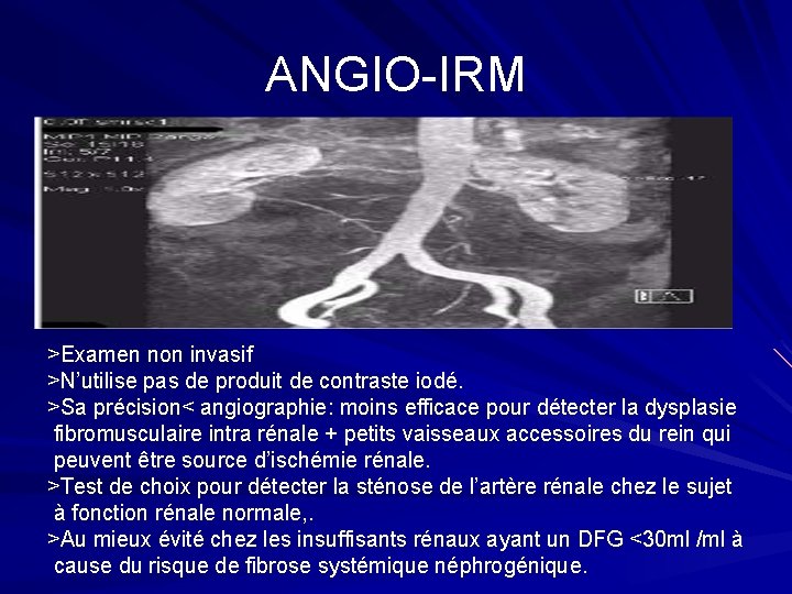 ANGIO-IRM >Examen non invasif >N’utilise pas de produit de contraste iodé. >Sa précision< angiographie: