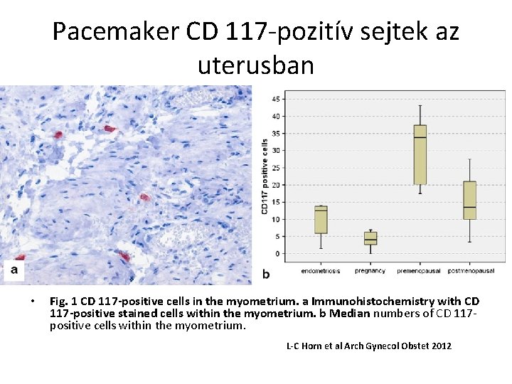 Pacemaker CD 117 -pozitív sejtek az uterusban • Fig. 1 CD 117 -positive cells