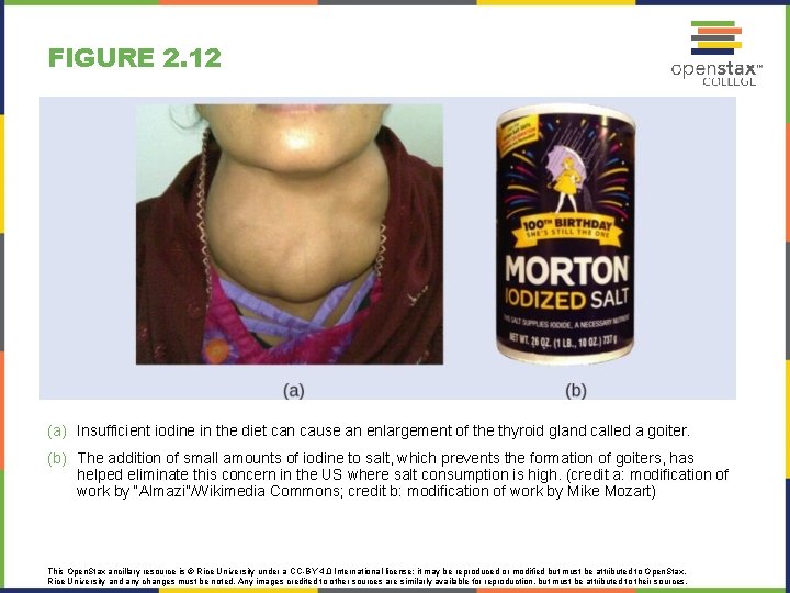FIGURE 2. 12 (a) Insufficient iodine in the diet can cause an enlargement of
