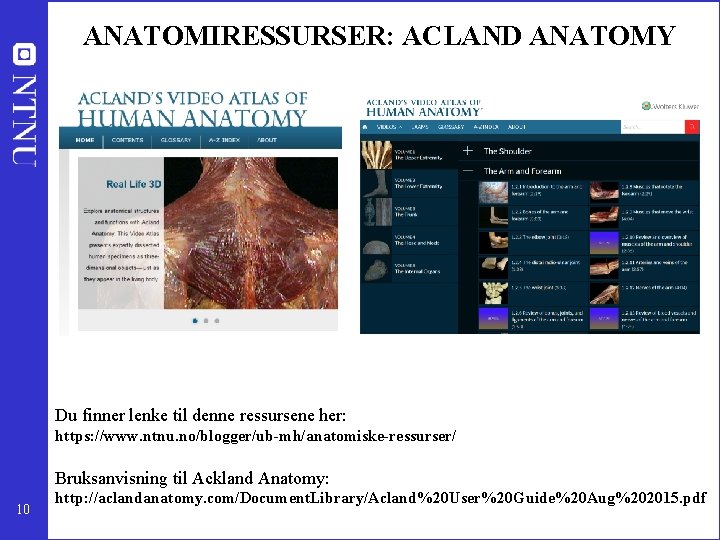 ANATOMIRESSURSER: ACLAND ANATOMY Du finner lenke til denne ressursene her: https: //www. ntnu. no/blogger/ub-mh/anatomiske-ressurser/