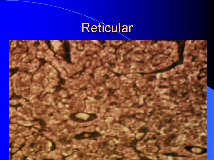 Reticular 