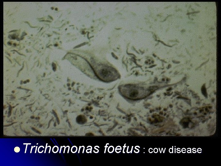 l Trichomonas foetus : cow disease 