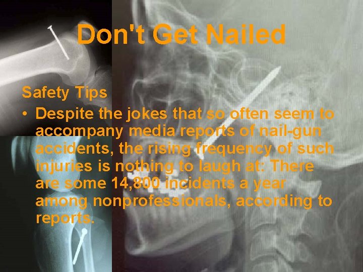 Don't Get Nailed Safety Tips • Despite the jokes that so often seem to