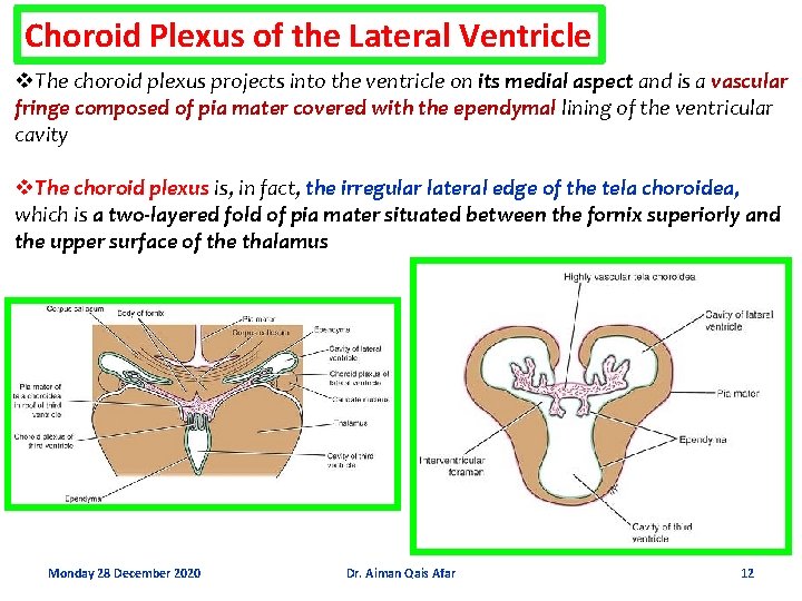Choroid Plexus of the Lateral Ventricle v. The choroid plexus projects into the ventricle
