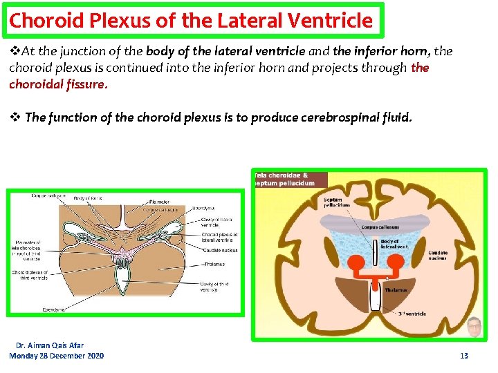 Choroid Plexus of the Lateral Ventricle v. At the junction of the body of