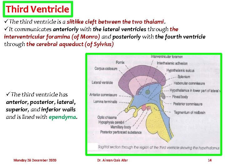 Third Ventricle üThe third ventricle is a slitlike cleft between the two thalami. üIt