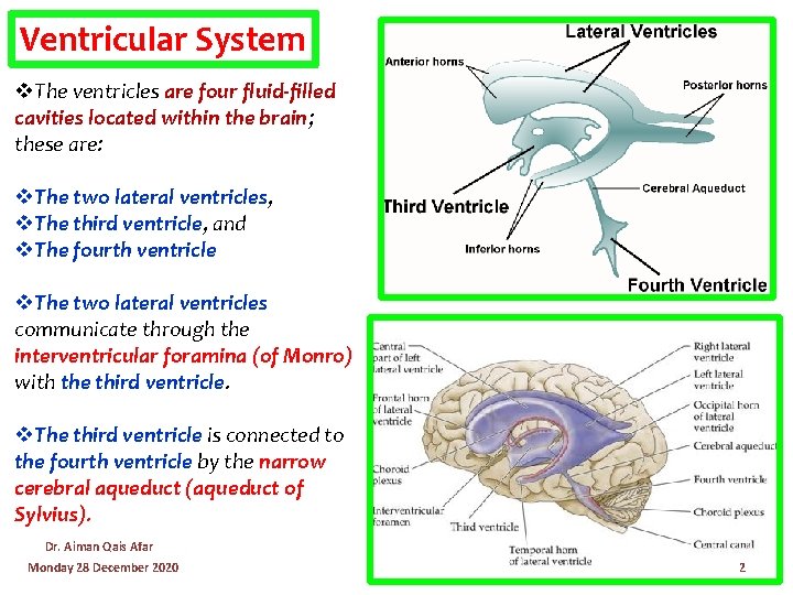 Ventricular System v. The ventricles are four fluid-filled cavities located within the brain; these