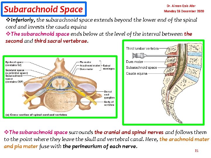 Subarachnoid Space Dr. Aiman Qais Afar Monday 28 December 2020 v. Inferiorly, the subarachnoid