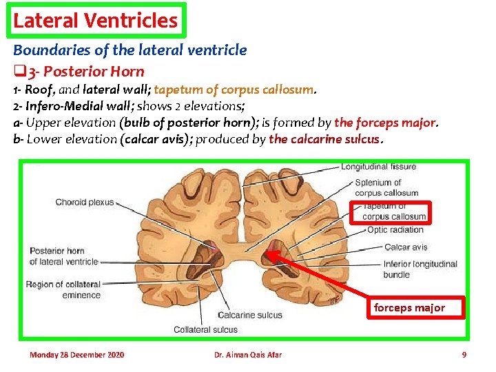 Lateral Ventricles Boundaries of the lateral ventricle q 3 - Posterior Horn 1 -