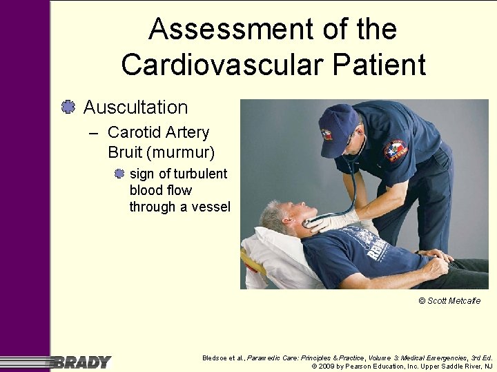 Assessment of the Cardiovascular Patient Auscultation – Carotid Artery Bruit (murmur) sign of turbulent Assessment of the Cardiovascular Patient Auscultation – Carotid Artery Bruit (murmur) sign of turbulent