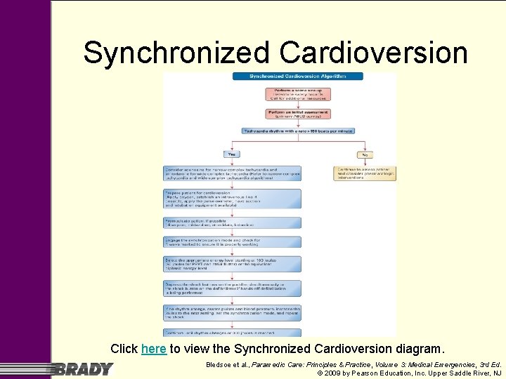 Synchronized Cardioversion Click here to view the Synchronized Cardioversion diagram. Bledsoe et al. , Synchronized Cardioversion Click here to view the Synchronized Cardioversion diagram. Bledsoe et al. ,