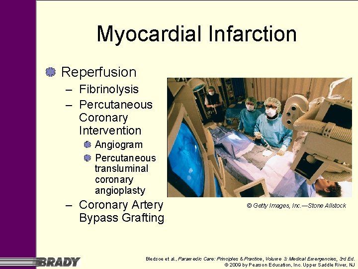 Myocardial Infarction Reperfusion – Fibrinolysis – Percutaneous Coronary Intervention Angiogram Percutaneous transluminal coronary angioplasty Myocardial Infarction Reperfusion – Fibrinolysis – Percutaneous Coronary Intervention Angiogram Percutaneous transluminal coronary angioplasty