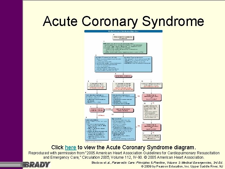 Acute Coronary Syndrome Click here to view the Acute Coronary Syndrome diagram. Reproduced with Acute Coronary Syndrome Click here to view the Acute Coronary Syndrome diagram. Reproduced with