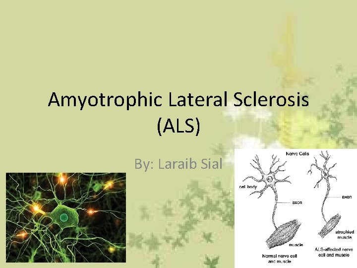 Amyotrophic Lateral Sclerosis (ALS) By: Laraib Sial 