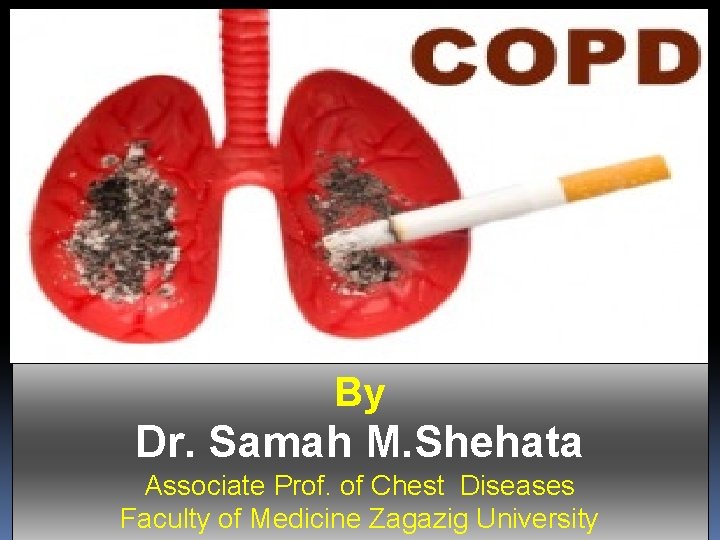 By Dr. Samah M. Shehata Associate Prof. of Chest Diseases Faculty of Medicine Zagazig