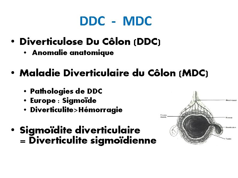 DDC - MDC • Diverticulose Du Côlon (DDC) • Anomalie anatomique • Maladie Diverticulaire