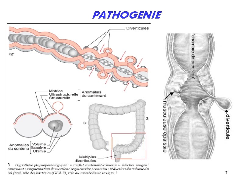 PATHOGENIE 7 