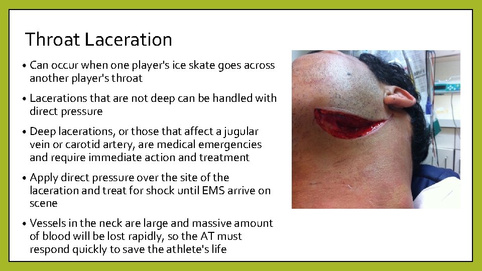 Throat Laceration • Can occur when one player's ice skate goes across another player's